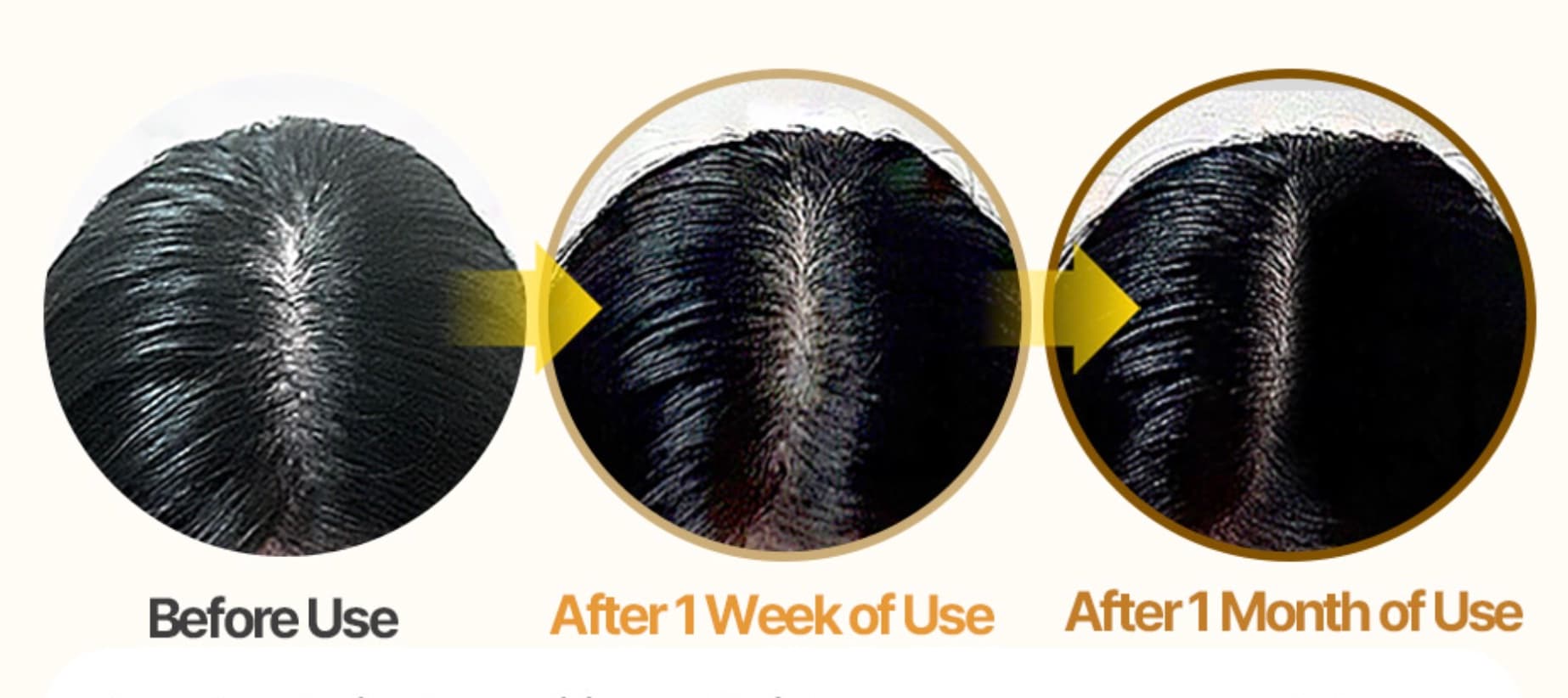 The same scalp photographed before use, after one week of use, and after one month of use.
