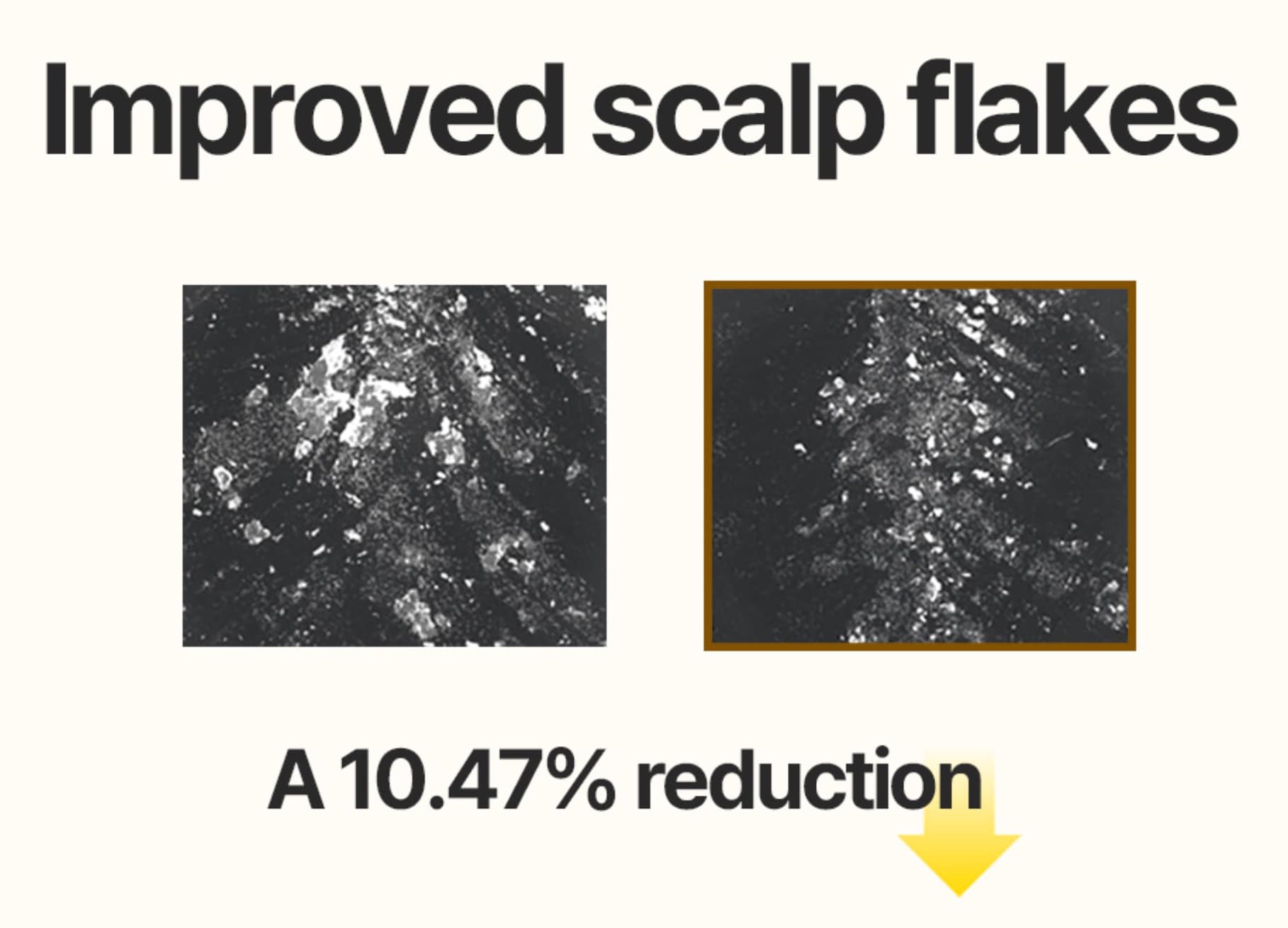 Magnified scalp surface, before use and after use, with fewer visible flakes.