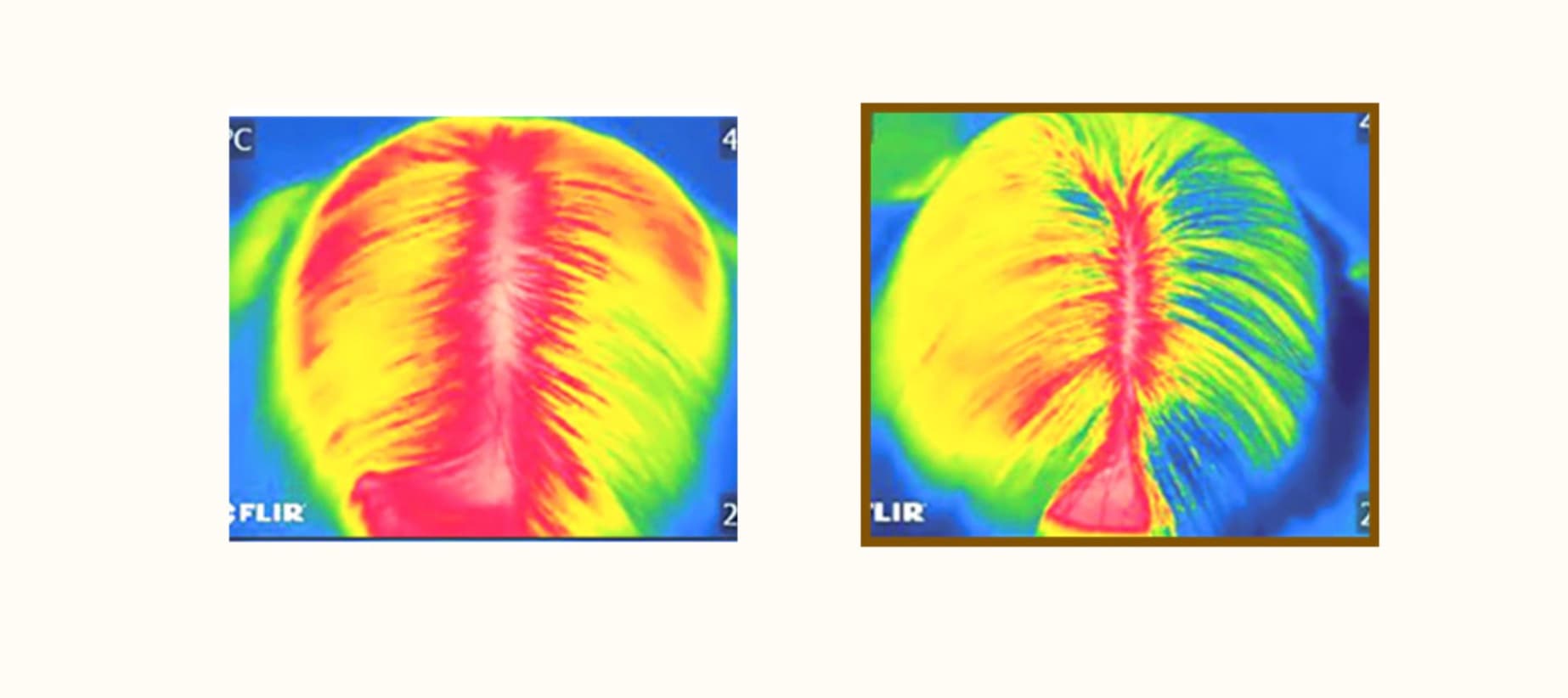 Two thermal (FLIR) images of the scalp, one taken before use and one after use.